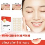 Eelhoe水胶体痘痘贴片隐形痘痘贴片清洁痘痘防水透气肌肉修复贴片