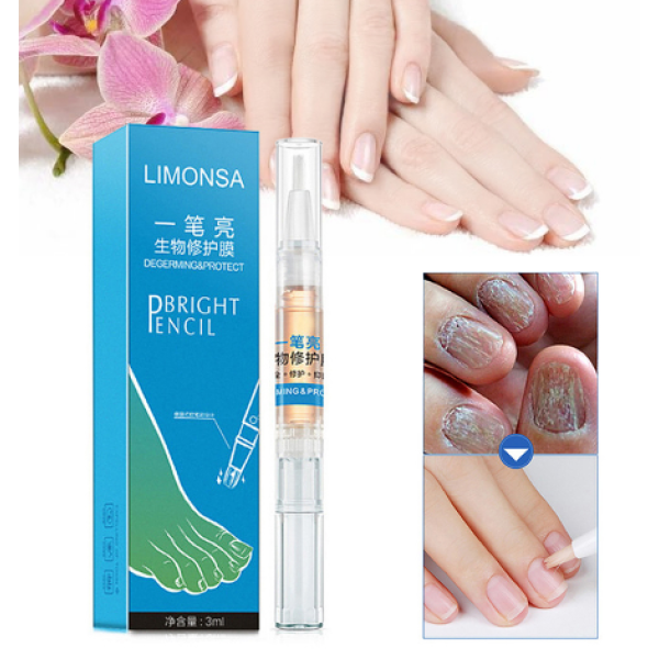 抗真菌治疗甲笔修复凝胶3ML甲真菌病甲癣感染花草指甲保健