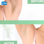 Wax Strips Factory - Customizable Long-lasting Non-woven