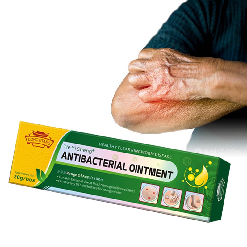 Factory Sales Herbal Antipruritic Cream Eczema Urticaria Alergy Skin Ointment