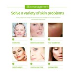 Factory Wholesale Natural Aloe Vera Antibacterial Cream Clear Facial Pimples Antibacterial Ointment