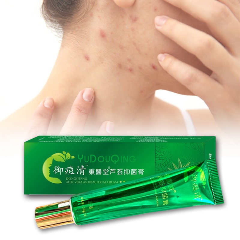 Private Label Acne Skin Cream Herbal Plant Formula Aloe Moisturizer Acne Cream