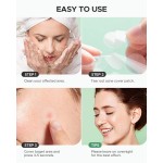 Popular Products Acne Healing Pimple Patch Support Customized Logo Invisible Hydrocolloid Acne Patch