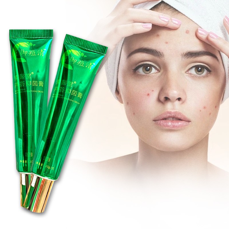 Factory Wholesale Natural Aloe Vera Antibacterial Cream Clear Facial Pimples Antibacterial Ointment