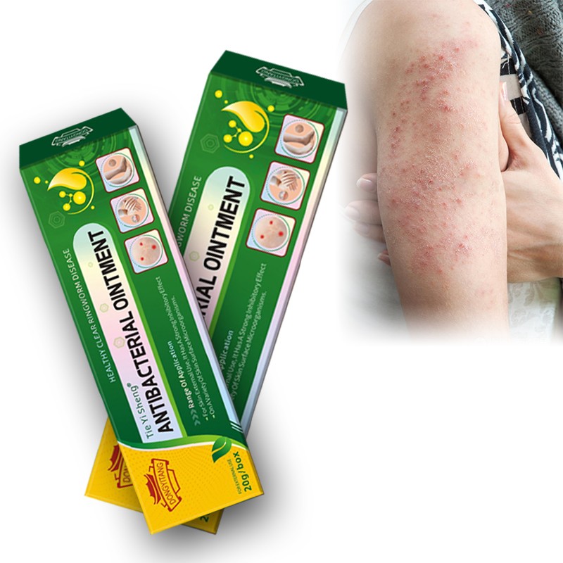 Factory Wholesale Topical Eczema Cream Skin Itching Jock Itch Ointment