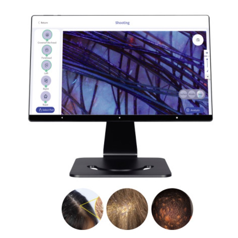 2025  Hair Scalp Analyzer Hair Scalp Machine for Beauty Salon