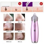 Facial Blackhead Remover Vacuum Pore Adsorber Electric Pimple Blackhead Cleaner USB Rechargeable Water Cycle Face Cleaning Tool