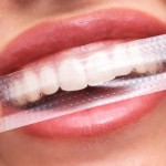 Non Peroxide Teeth Whitening Strips Manufacturer - Fruit Flavor