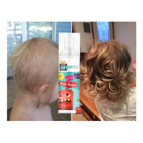 Hair Growth Serum Supplier - Private Label Sulfate Free Vegan Serum