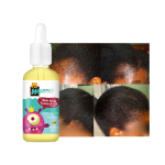 Baby Hair Protect Oil Manufacturer - Sulfate Free Moisture Nourish Scalp