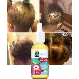 Kids Hair Growth Oil Supplier - Strengthen Protect Baby Hair Private Label
