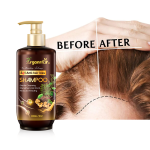 Anti Hair Loss Shampoo Factory - Delicate Cleansing 3 in 1 Treatment