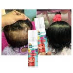 Hair Growth Serum Supplier - Free Sample Vegan Biotin for Frizzy Hair