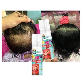 Hair Growth Serum Supplier - Free Sample Vegan Biotin for Frizzy Hair