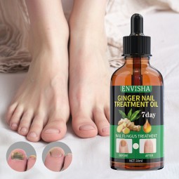 Nail Fungus Treatment Supplier - Plant Ingredients 7 Day Repair
