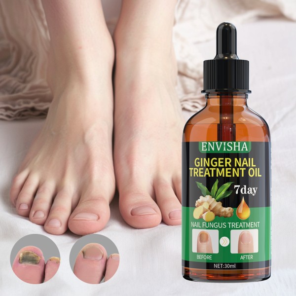 Nail Fungus Treatment Supplier - Plant Ingredients 7 Day Repair