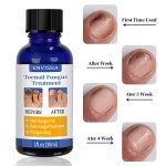 Nail Fungus Treatment Factory - Wholesale Anti Fungal Nail Repair