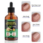 Nail Fungus Treatment Supplier - Plant Ingredients 7 Day Repair