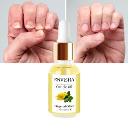 Healing Ointment Supplier - Travel Size Cracked Skin Cream