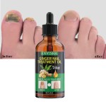 Spot Remover Supplier - Organic Body Underarm Whitening Cream