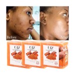 Soap Manufacturer - Natural Essential Oil Ginger Acne Dark Spot