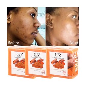 Soap Manufacturer - Natural Essential Oil Ginger Acne Dark Spot