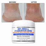 Foot Care Lotion Stick Factory - Urea Softening Moisturizing Dead Skin