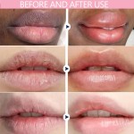 Lip Serum Supplier - Uiz Pink Remove Dark Moisturizing Treatment
