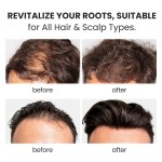 Hair Growth Shampoo Supplier - Wholesale Oil Control Ginseng Activator