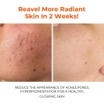 Mud Mask Manufacturer - Turmeric Deep Cleansing Pores Oil Control