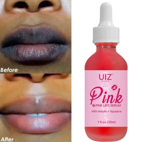 Lip Treatment Oil Manufacturer - Uiz Pink Lightening Bleaching Hydrating