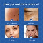 Freckle Remover Factory - Super Skin Repair Lotion Spot Correcting