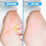 Diaper Balm Manufacturer - Redness Relief Soothing Zinc Oxide