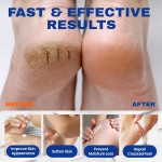 Foot Care Lotion Stick Factory - Urea Softening Moisturizing Dead Skin