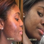 Freckle Remover Factory - Super Skin Repair Lotion Spot Correcting