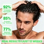 Hair Growth Shampoo Supplier - Wholesale Oil Control Ginseng Activator