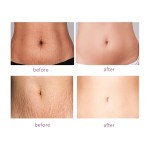 Stretch Mark Oil Factory - Vitamin E Argan Oil Postpartum Repair