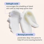 Acne Skin Care Kit Supplier - Private Label 3-Step Acne Clearing