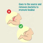 Diaper Spray Supplier - 100% Natural Hypochlorous Germs Removal