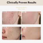 Rice Serum Manufacturer - Alpha Arbutin 2% Uneven Skin Tone