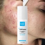 Acne Cream Supplier - Salicylic Acid Pimple Removal Pore Shrinking