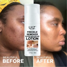 Freckle Remover Factory - Super Skin Repair Lotion Spot Correcting