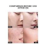 Face Wash Supplier - NEW 2-In-1 Herbal Fruit Amino Acid