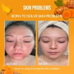 Turmeric Skin Care Set Factory - Private Label Serum Cream Toner Mask
