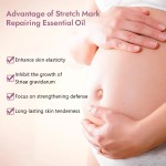 Stretch Mark Oil Factory - Vitamin E Argan Oil Postpartum Repair