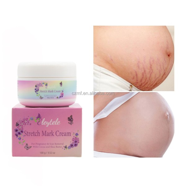 Stretch Mark Cream Manufacturer - OEM/ODM Wholesale Private Label Natural Organic