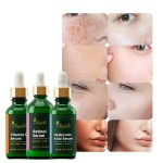 Tranexamic Acid Serum Manufacturer - OEM/ODM Wholesale Private Label Natural Organic Whitening