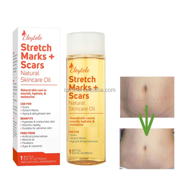 Stretch Mark Removal Oil Manufacturer - OEM/ODM Wholesale Private Label Natural Smooth