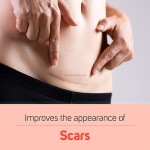 Stretch Mark Oil Manufacturer - OEM/ODM Private Label Best Natural Organic Skincare