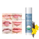 Lip Balm Set Manufacturer - OEM/ODM Private Label Custom Natural Long-lasting Fruit